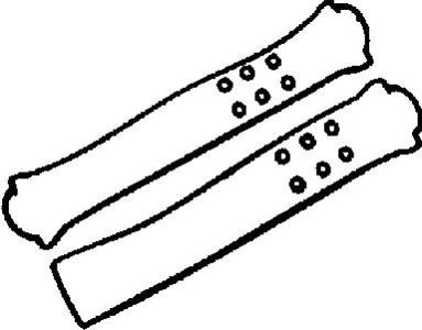 Uszczelka pokrywy zaworów REINZ 15-52601-01 1121374010